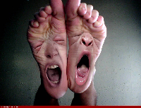 Painful feet-553